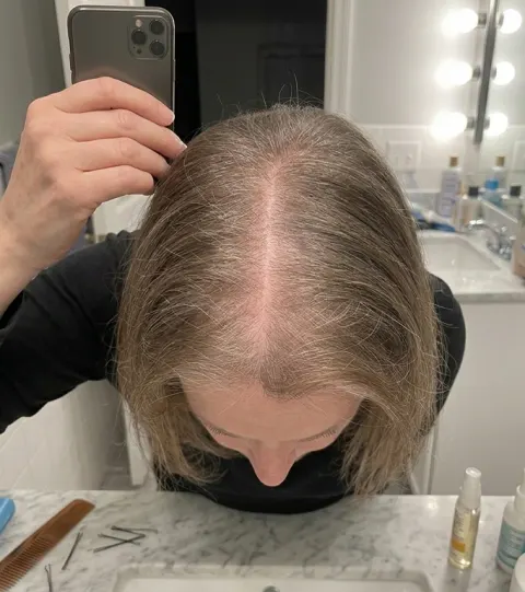 Patricia, before — looking tired in bed at sunrise