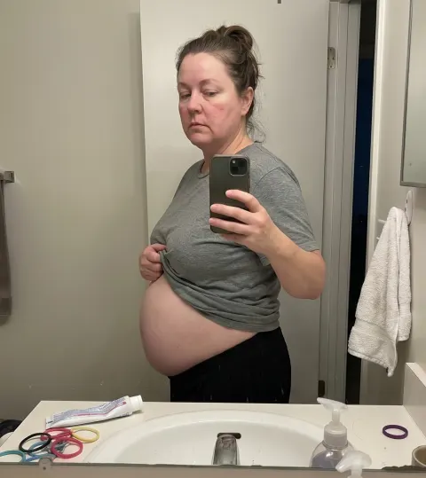 Linda, before — bloated, in a heavy grey t-shirt